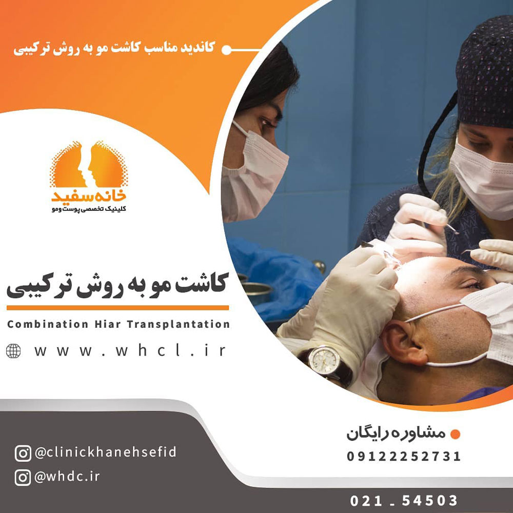 تبلیغ کلینیک خانه سفید کاشت مو