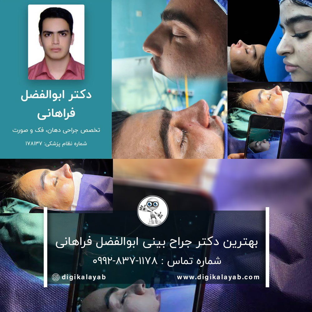 بهترین دکتر جراح بینی در انقلاب (تهران)
