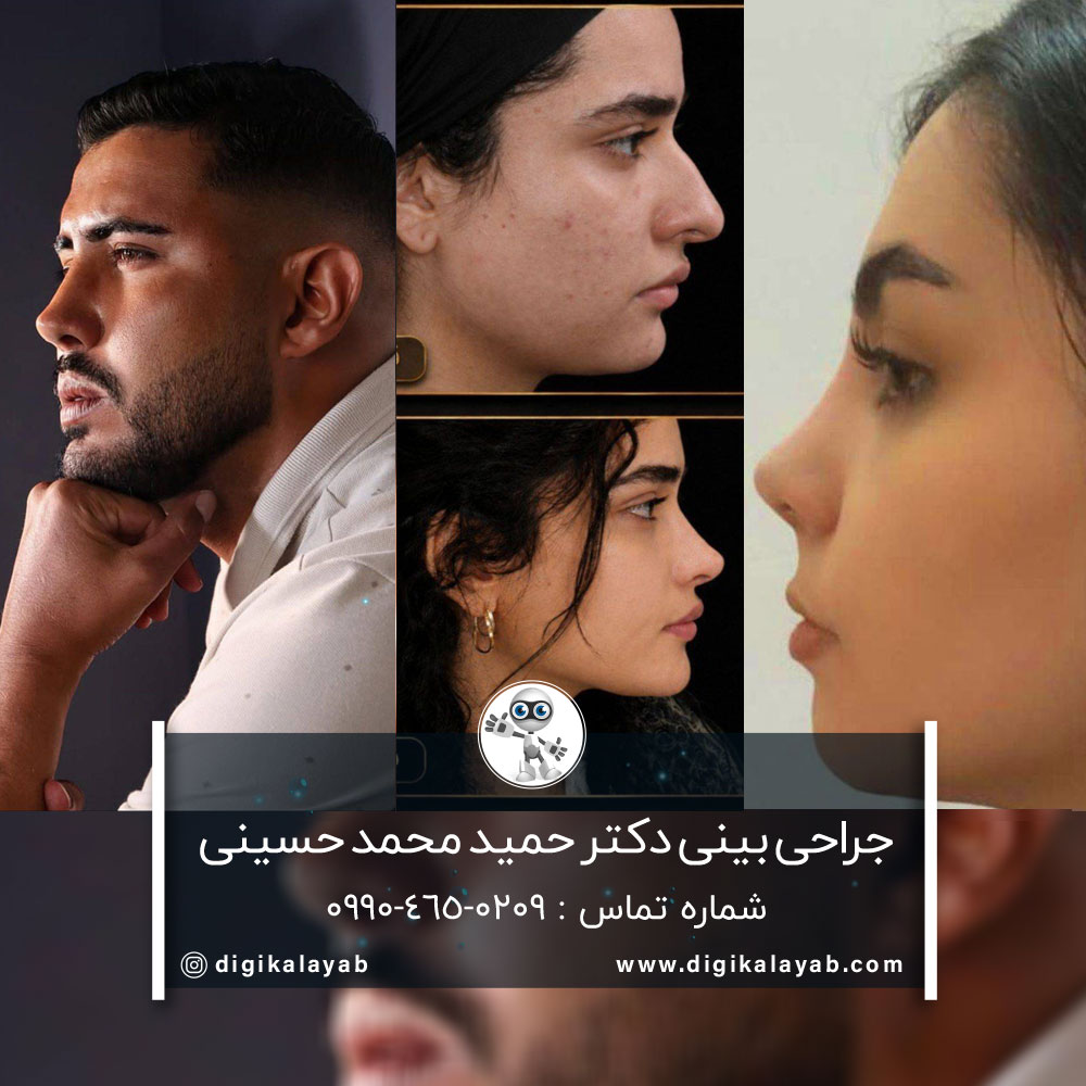 جراحی بینی با بیش از 15 سال سابقه در شریعتی (تهران)