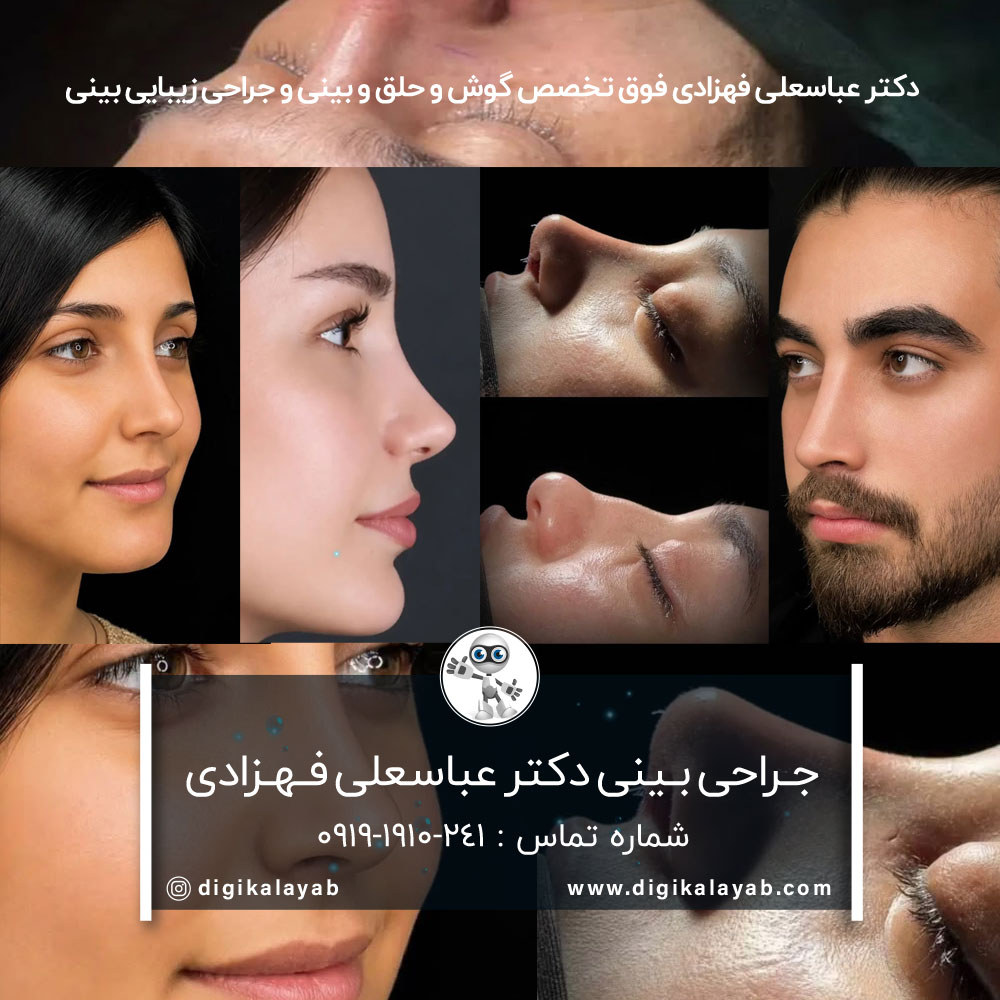 آگهی جراحی بینی پیزوسرجری با بیش از 20 سال سابقه در اقدسیه (تهران)
