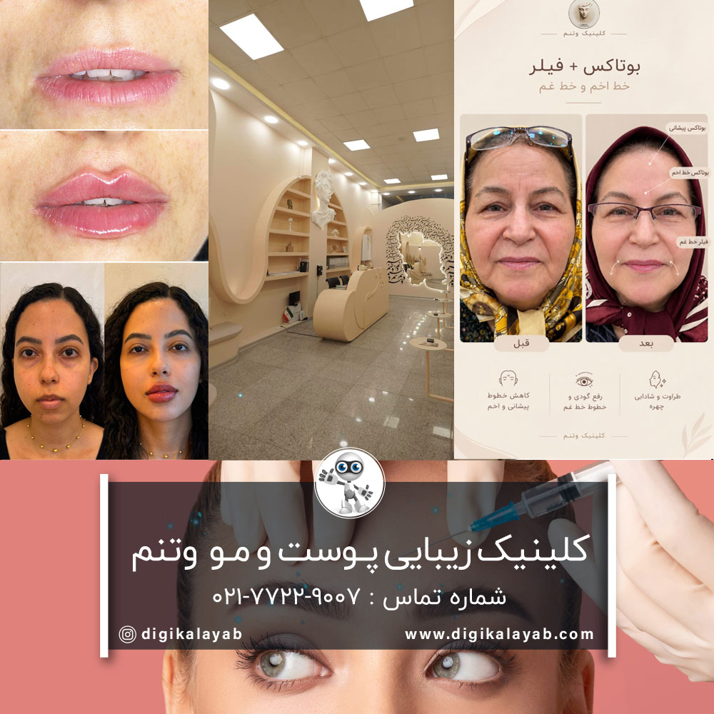 بهترین کلینیک زیبایی تزریق ژل و تزریق بوتاکس در تهرانپارس و نارمک (فرجام)